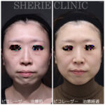私が考える美容クリニックによって値段が違う理由