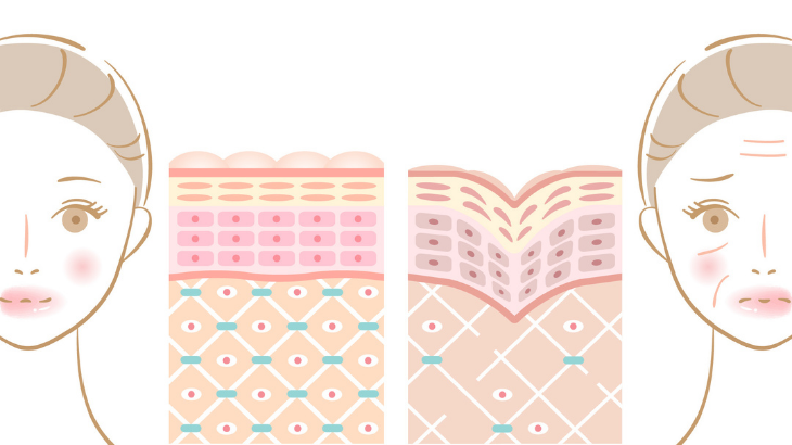 老け見えの原因は？骨・脂肪・皮膚の3段階で考える、たるみ治療