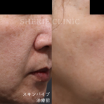 【全国トップクラスの消費量】シェリーのスキンバイブがいい理由