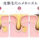 【井上健太郎医師監修】ベタつく毛穴悩みに「皮脂を抑えて引き締める、毛穴改善ガイド」