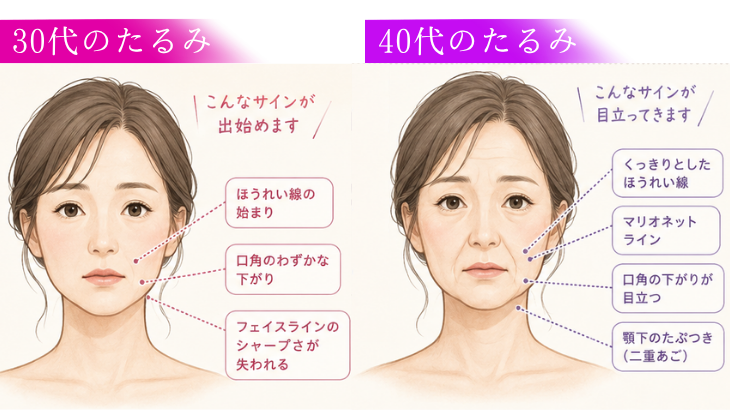 30代・40代に「糸リフト」が人気な理由