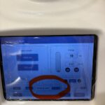 ピコトーニングのショット数、見たことありますか？