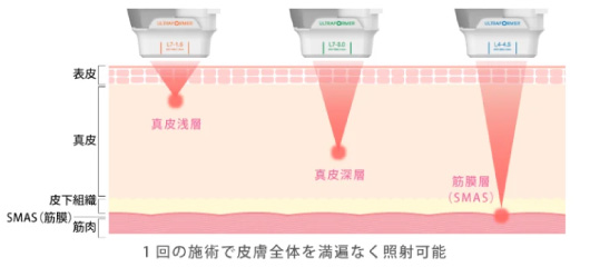 たるみの原因に直接アプローチ