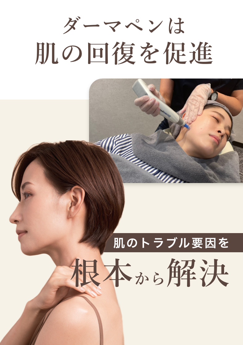 ダーマペンは肌の回復を促進！肌のトラブル要因を根本から解決