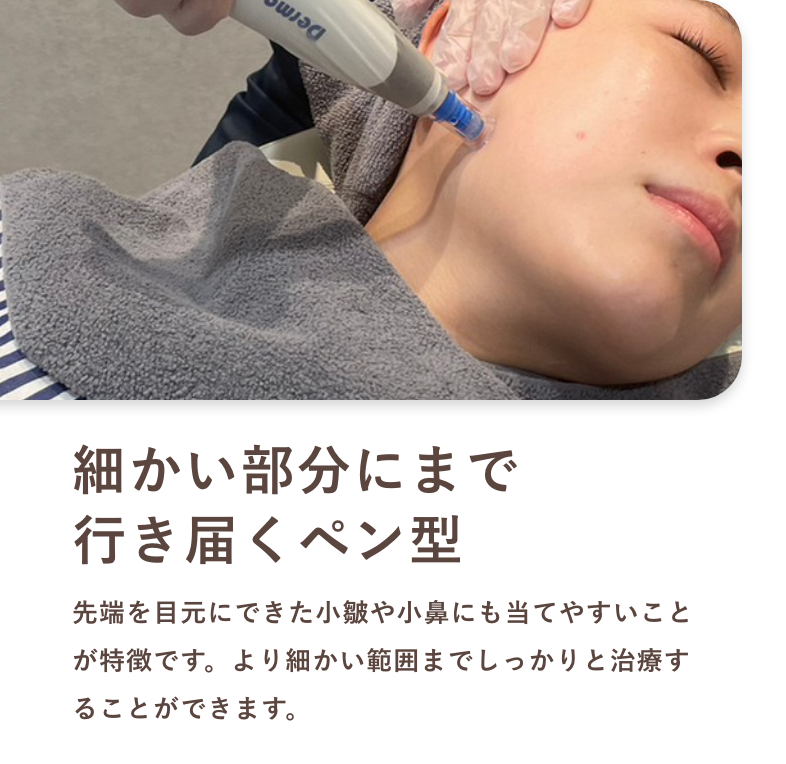 細かい部分にまで行き届くペン型