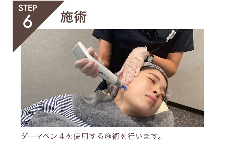STEP6.施術