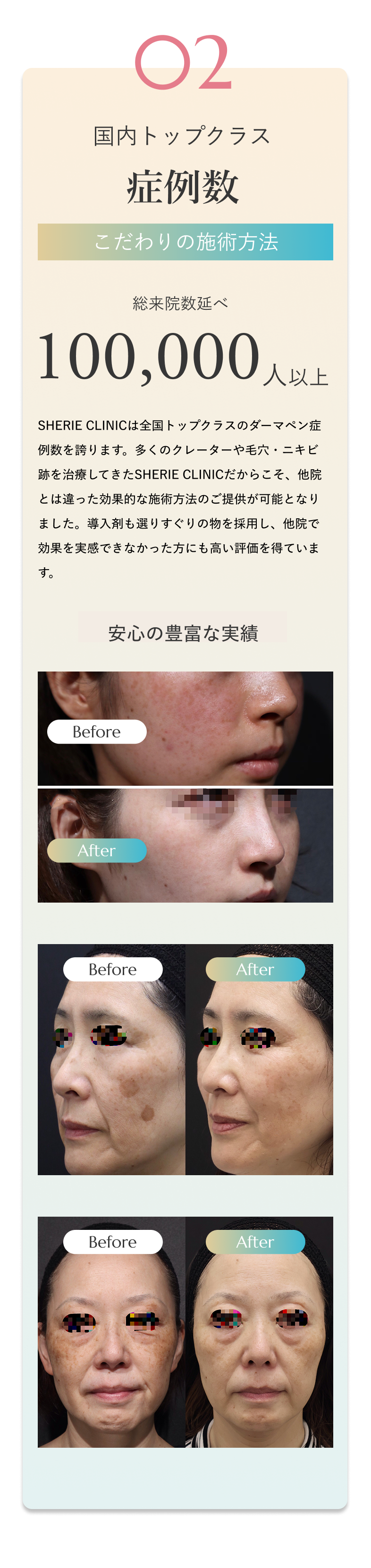 02 トップクラスの症例数