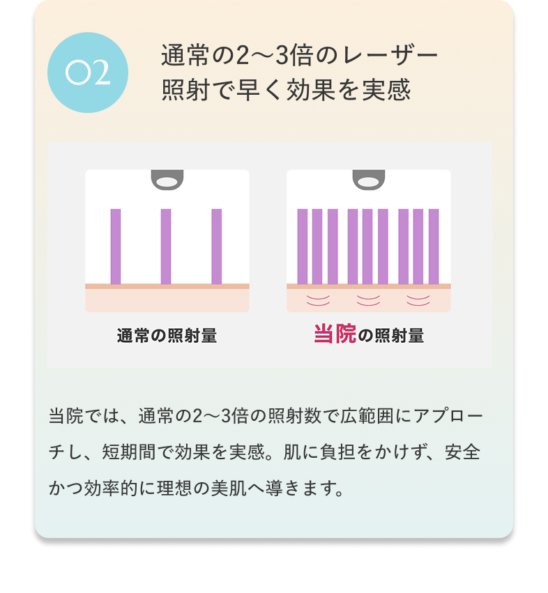 02 通常の2〜3倍のレーザー照射で早く効果を実感