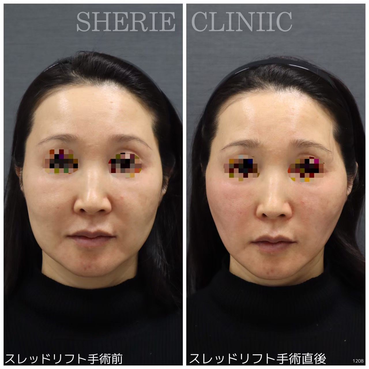 1a2de87a2e325f58eb61d12b2039f0