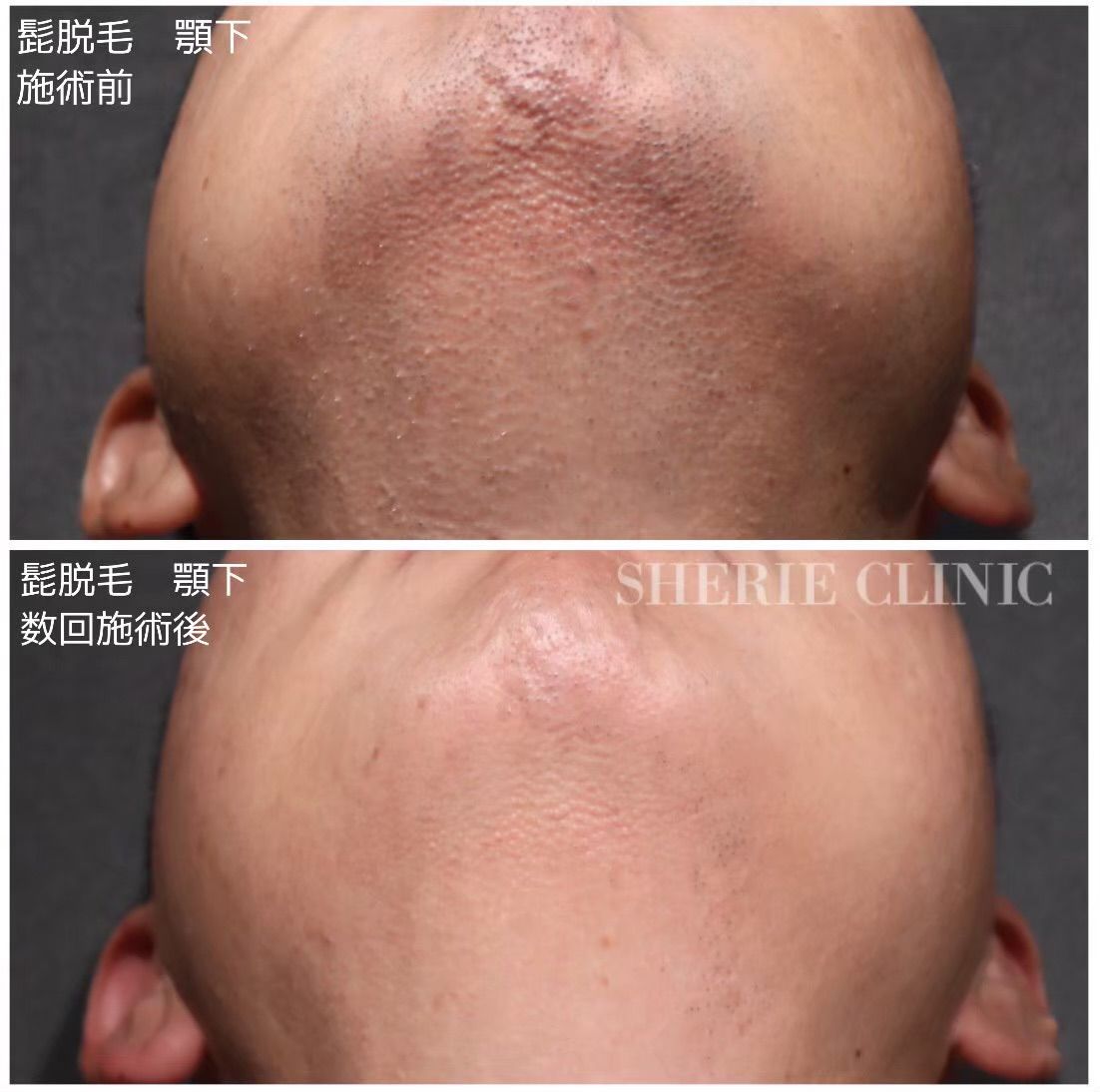 3ccddc13fa553993d21790a415ca78