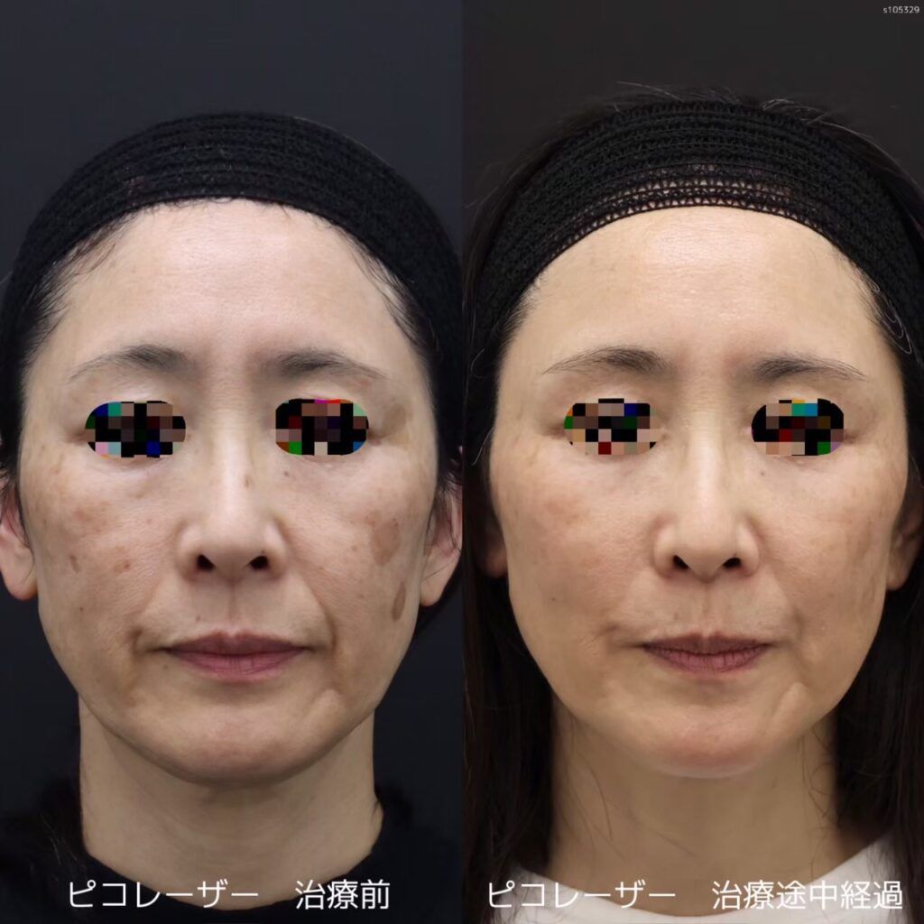 美容クリニックで“コース通い”するメリットとは？