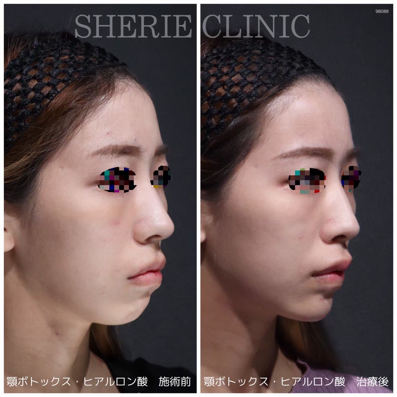 5e5926e2c80a187e6459f0b8be3e71