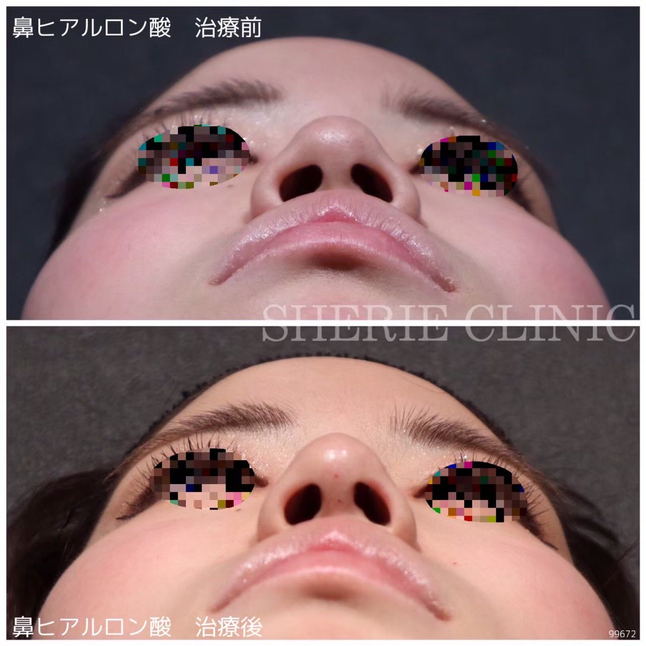 9cf8b36f6546f0cc9c0716b61dff29