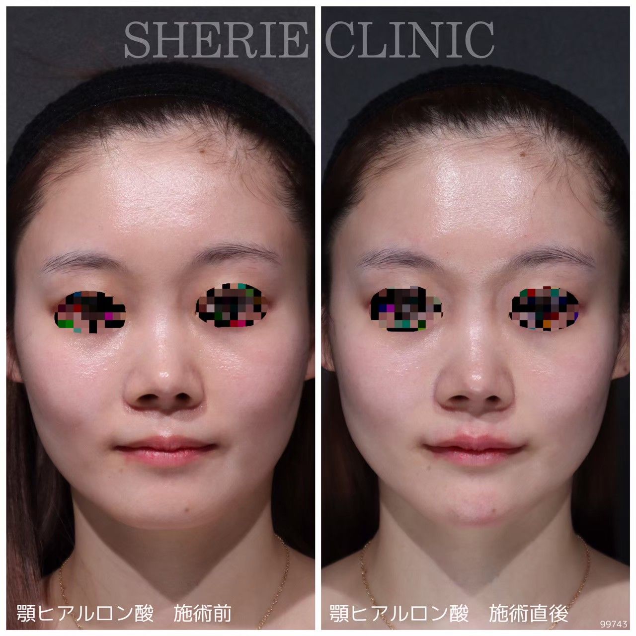 cfb69f3bb1f6e20bee2ddd176cf3b7