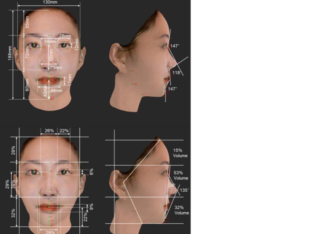 美人の条件はおでこが丸いこと？【美人コンテストを徹底検証】