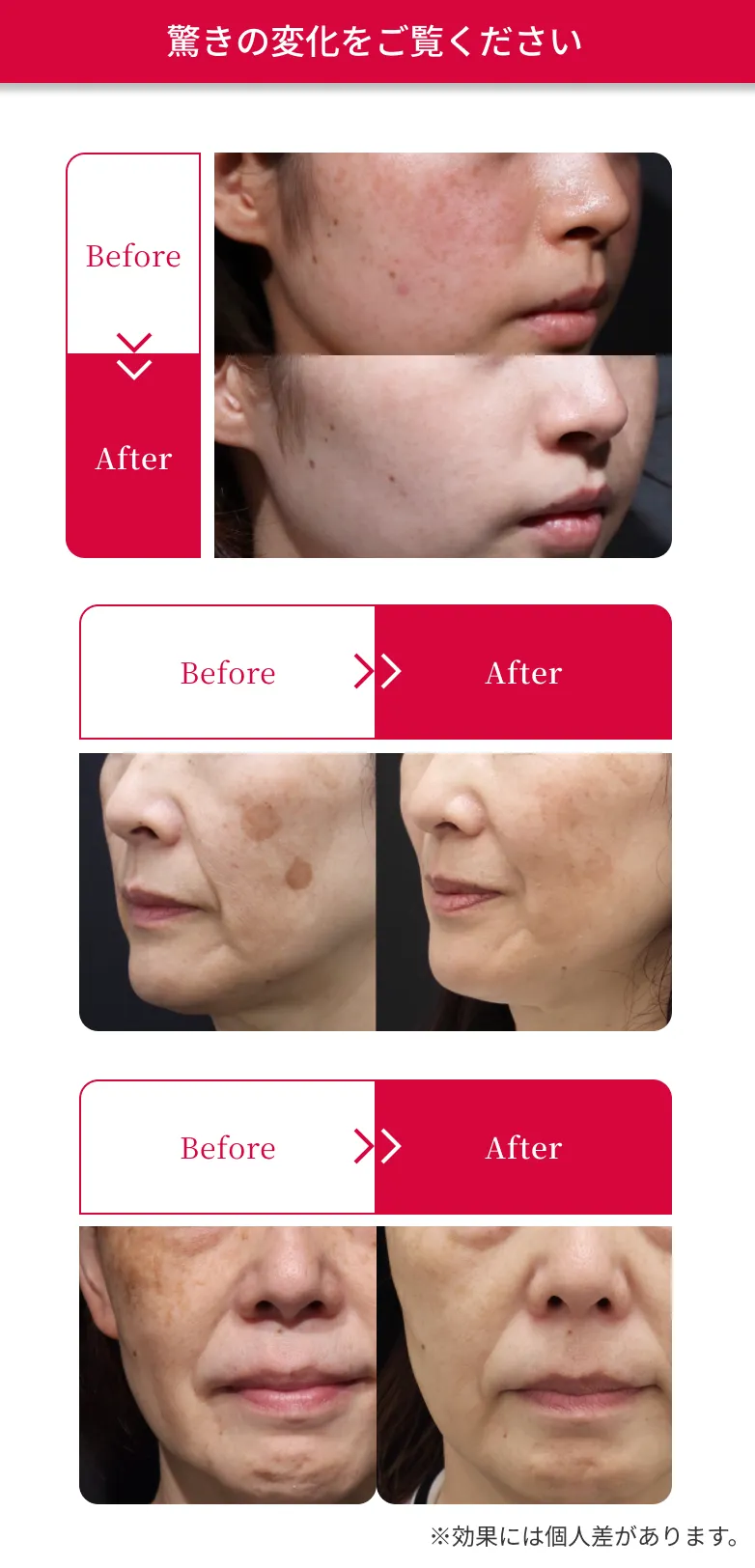 驚きの変化をご覧ください